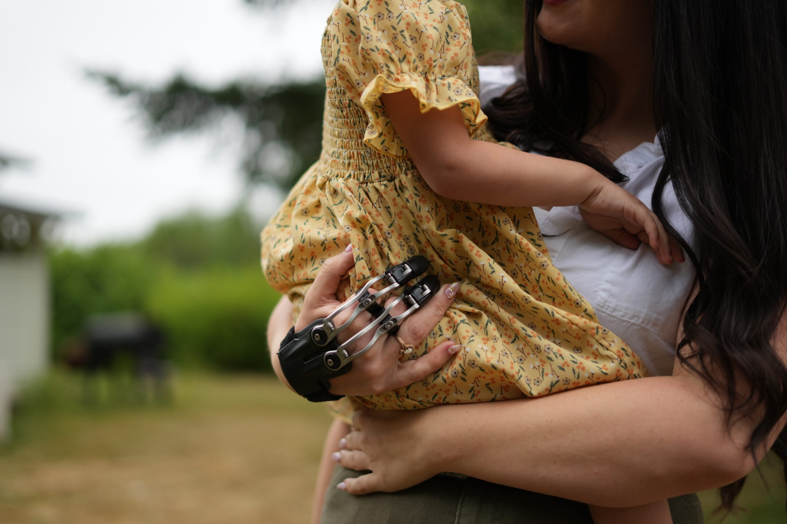 Woman who lost fingers in woodworking accident gets prosthesis, new outlook  on life